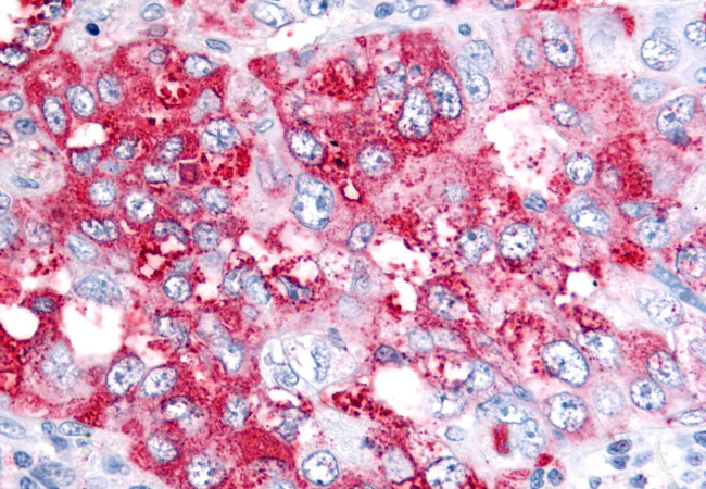 Bestrophin 4 Antibody in Immunohistochemistry (Paraffin) (IHC (P))