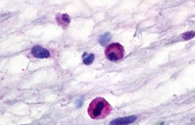 C3a Receptor Antibody in Immunohistochemistry (Paraffin) (IHC (P))