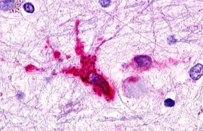 C3a Receptor Antibody in Immunohistochemistry (Paraffin) (IHC (P))