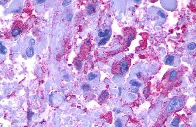 GPR77 Antibody in Immunohistochemistry (Paraffin) (IHC (P))