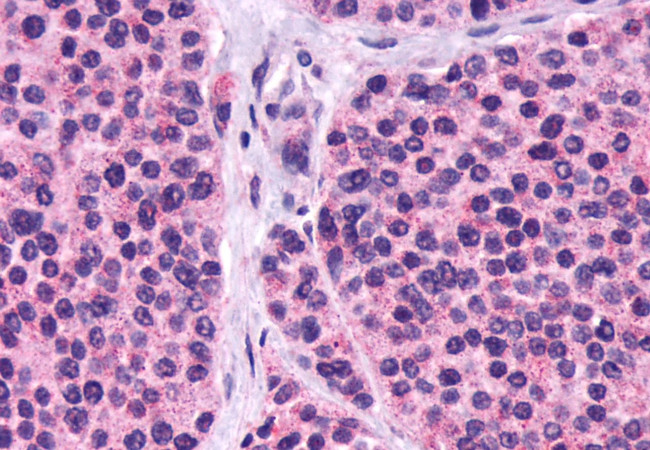 Calcium Sensing Receptor Antibody in Immunohistochemistry (Paraffin) (IHC (P))