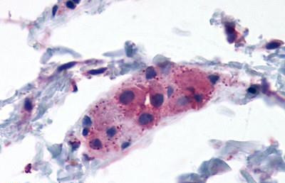 Calcium Sensing Receptor Antibody in Immunohistochemistry (Paraffin) (IHC (P))