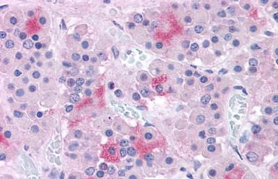 Calcium Sensing Receptor Antibody in Immunohistochemistry (Paraffin) (IHC (P))