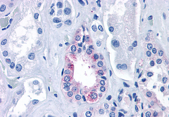 Calcium Sensing Receptor Antibody in Immunohistochemistry (Paraffin) (IHC (P))