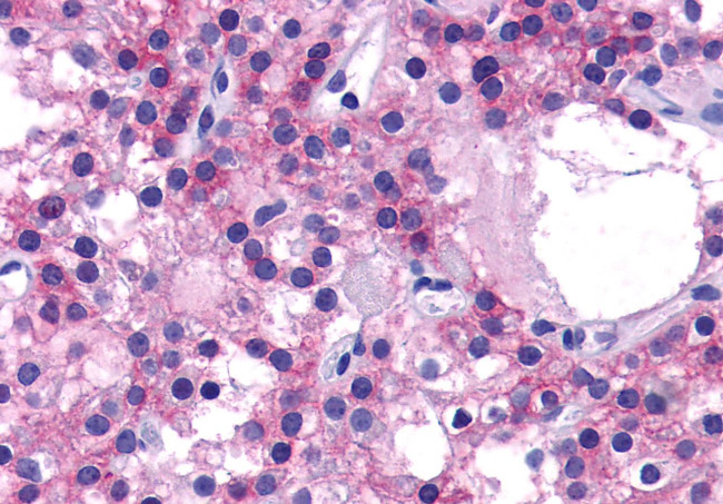 Calcium Sensing Receptor Antibody in Immunohistochemistry (Paraffin) (IHC (P))