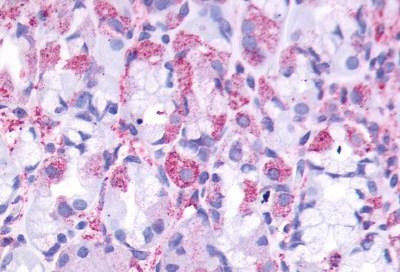 CCKBR Antibody in Immunohistochemistry (Paraffin) (IHC (P))