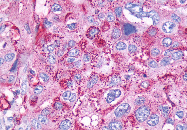 CCKBR Antibody in Immunohistochemistry (Paraffin) (IHC (P))