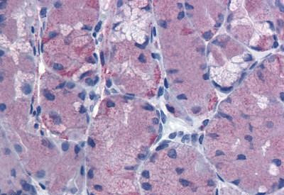 CCKBR Antibody in Immunohistochemistry (Paraffin) (IHC (P))