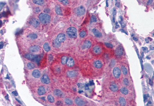 CCKBR Antibody in Immunohistochemistry (Paraffin) (IHC (P))