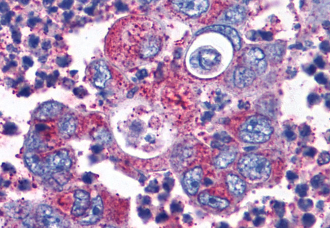 CCKBR Antibody in Immunohistochemistry (Paraffin) (IHC (P))