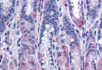 CCKBR Antibody in Immunohistochemistry (Paraffin) (IHC (P))