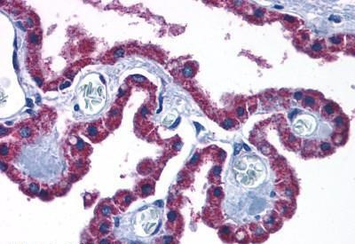 CCKBR Antibody in Immunohistochemistry (Paraffin) (IHC (P))