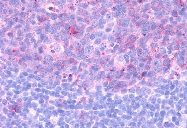 CCR3 Antibody in Immunohistochemistry (Paraffin) (IHC (P))