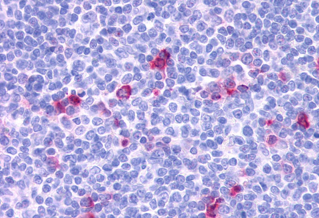 CCR3 Antibody in Immunohistochemistry (Paraffin) (IHC (P))