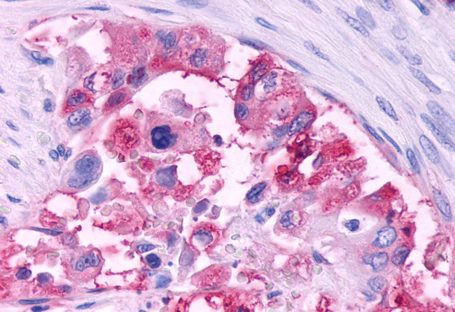 CCR3 Antibody in Immunohistochemistry (Paraffin) (IHC (P))