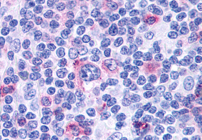 CCR3 Antibody in Immunohistochemistry (Paraffin) (IHC (P))