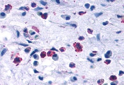 CCR3 Antibody in Immunohistochemistry (Paraffin) (IHC (P))