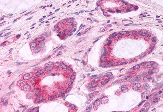 CCR3 Antibody in Immunohistochemistry (Paraffin) (IHC (P))