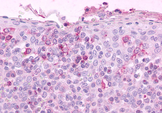 CCR3 Antibody in Immunohistochemistry (Paraffin) (IHC (P))