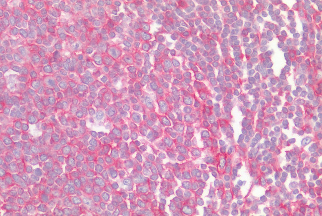 CCR6 Antibody in Immunohistochemistry (Paraffin) (IHC (P))