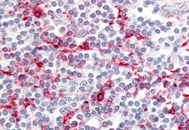 CCR6 Antibody in Immunohistochemistry (Paraffin) (IHC (P))