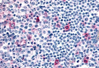 CCR8 Antibody in Immunohistochemistry (Paraffin) (IHC (P))