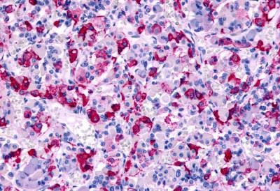 CCR8 Antibody in Immunohistochemistry (Paraffin) (IHC (P))