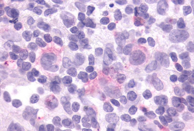 CCR9 Antibody in Immunohistochemistry (Paraffin) (IHC (P))