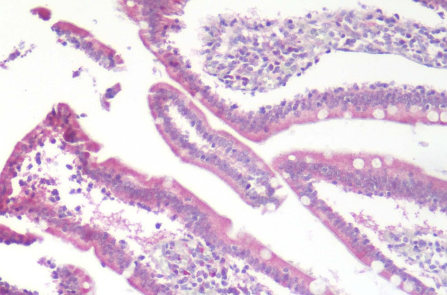 CCR9 Antibody in Immunohistochemistry (Paraffin) (IHC (P))