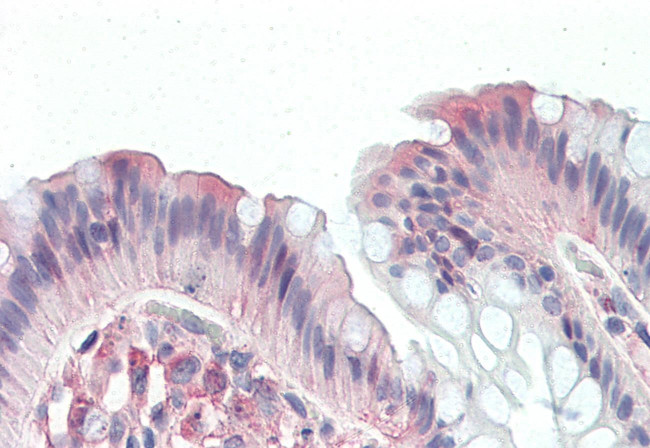 CD97 Antibody in Immunohistochemistry (Paraffin) (IHC (P))