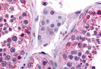 Cdc7 Antibody in Immunohistochemistry (Paraffin) (IHC (P))