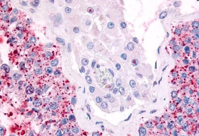 Cdc7 Antibody in Immunohistochemistry (Paraffin) (IHC (P))