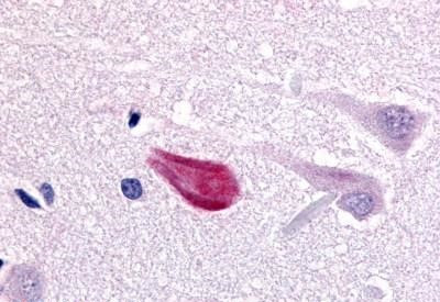 Cdc7 Antibody in Immunohistochemistry (Paraffin) (IHC (P))