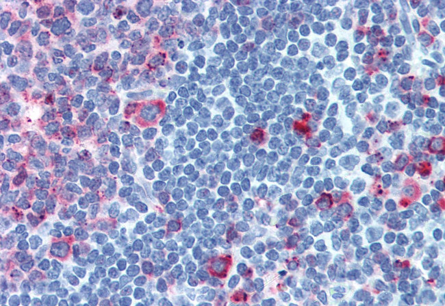 CELSR1 Antibody in Immunohistochemistry (Paraffin) (IHC (P))