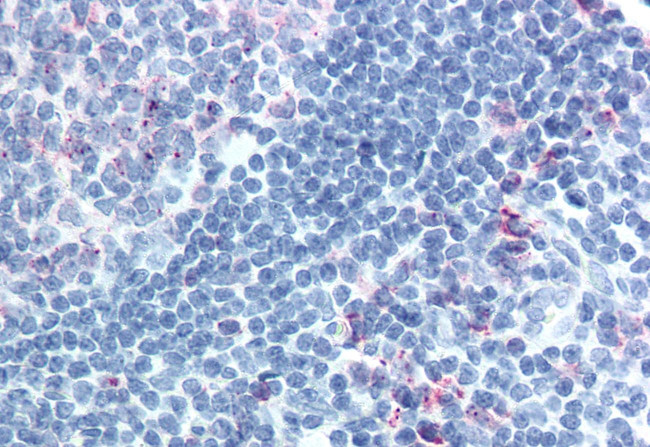 CELSR1 Antibody in Immunohistochemistry (Paraffin) (IHC (P))