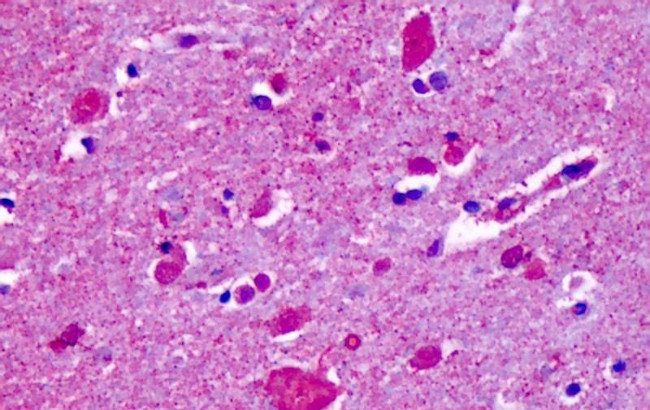 CELSR2 Antibody in Immunohistochemistry (Paraffin) (IHC (P))