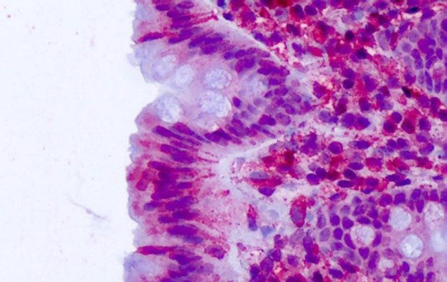 CELSR2 Antibody in Immunohistochemistry (Paraffin) (IHC (P))