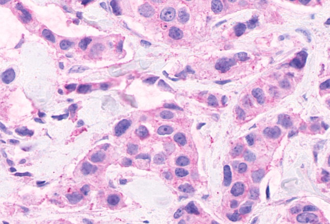 CELSR2 Antibody in Immunohistochemistry (Paraffin) (IHC (P))