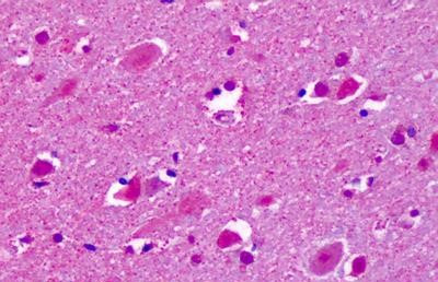 CELSR2 Antibody in Immunohistochemistry (Paraffin) (IHC (P))