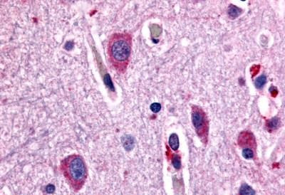 CHRM2 Antibody in Immunohistochemistry (Paraffin) (IHC (P))