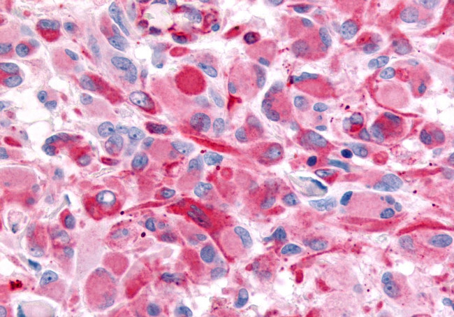 CHRM2 Antibody in Immunohistochemistry (Paraffin) (IHC (P))