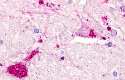 CMKLR1 Antibody in Immunohistochemistry (Paraffin) (IHC (P))