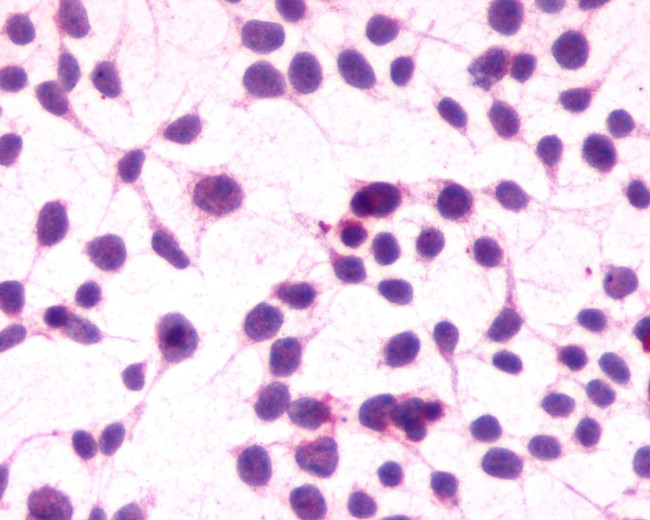 Cannabinoid Receptor 1 Antibody in Immunocytochemistry (ICC/IF)