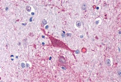 Cannabinoid Receptor 1 Antibody in Immunohistochemistry (Paraffin) (IHC (P))