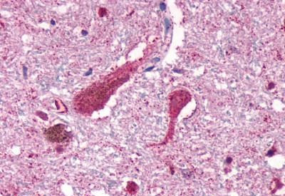 Cannabinoid Receptor 1 Antibody in Immunohistochemistry (Paraffin) (IHC (P))