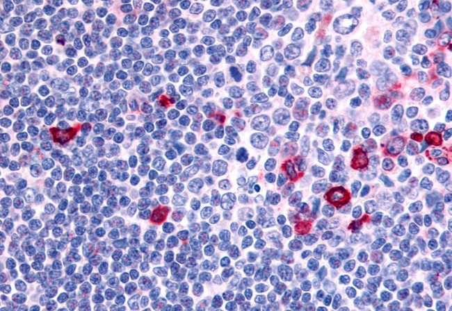 CNR2 Antibody in Immunohistochemistry (Paraffin) (IHC (P))