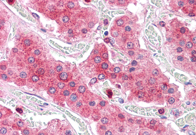 COMT Antibody in Immunohistochemistry (Paraffin) (IHC (P))