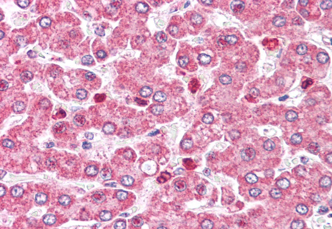 COMT Antibody in Immunohistochemistry (Paraffin) (IHC (P))