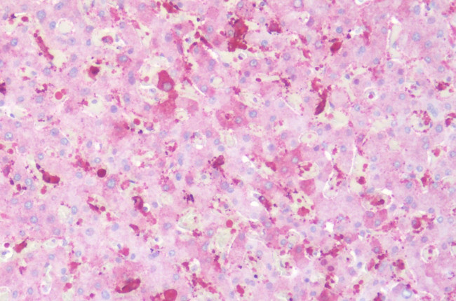 CXCR1 Antibody in Immunohistochemistry (Paraffin) (IHC (P))