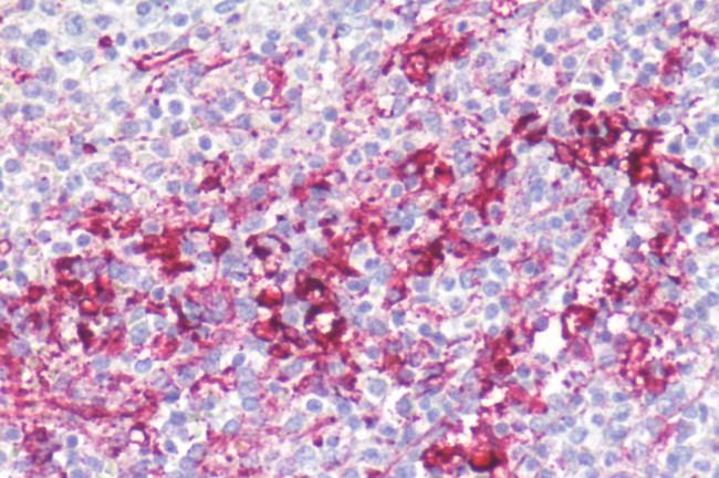 CXCR1 Antibody in Immunohistochemistry (Paraffin) (IHC (P))